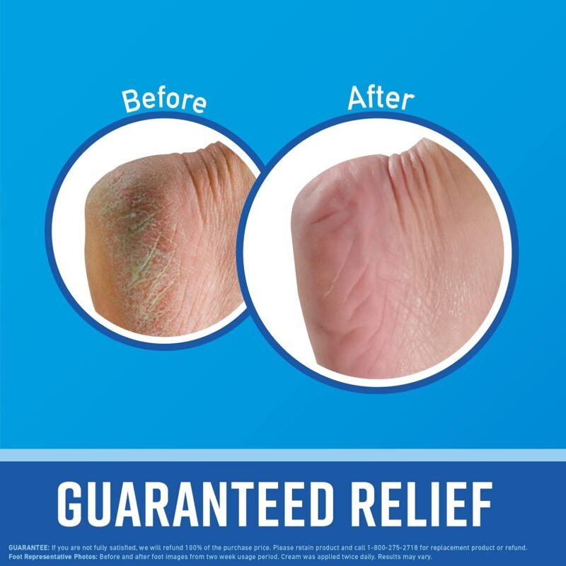 O'Keeffe's for Healthy Feet Foot Cream - Image 2